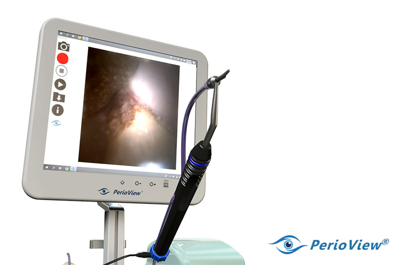 Cone Beam CT Imaging in Eastern Washington