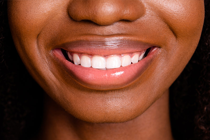 Dental Crown Lengthening in Eastern Washington