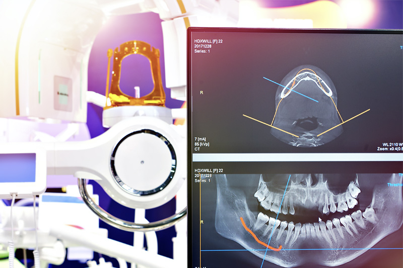 Digital X-Rays in Eastern Washington